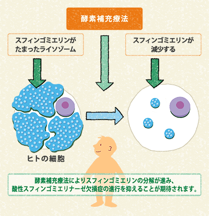 図2 酸性スフィンゴミエリナーゼ欠損症（ASMD）の酵素補充療法