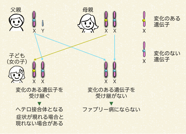 母親が変化のある遺伝子を持っていて、子どもが女の子の場合（変化のある遺伝子を受け継ぐ確率と受け継がない確率はどちらも50％）