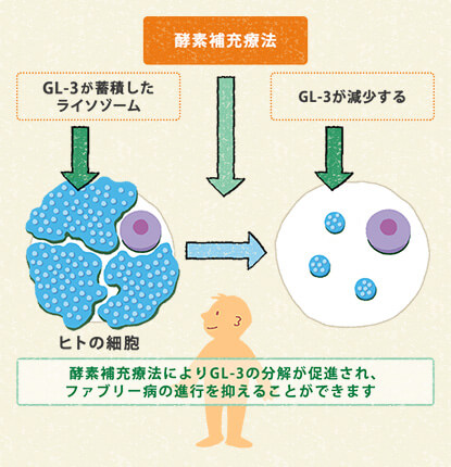 図2　ファブリー病の酵素補充療法