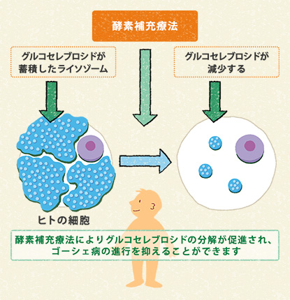 図3　ゴーシェ病の酵素補充療法