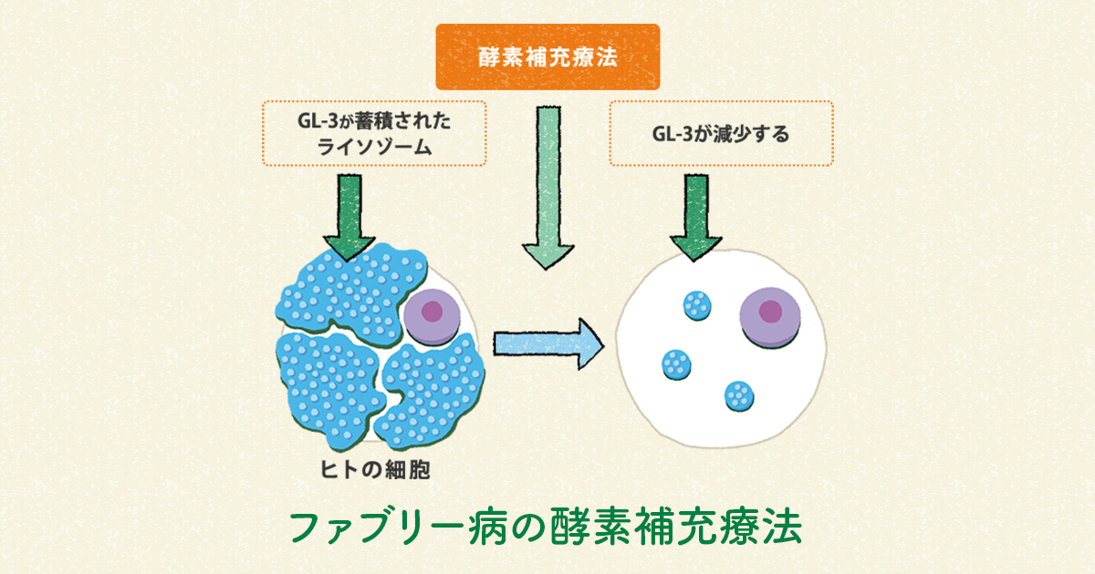 ファブリー病の治療法は？｜ライソゾーム病サイト ライソライフ