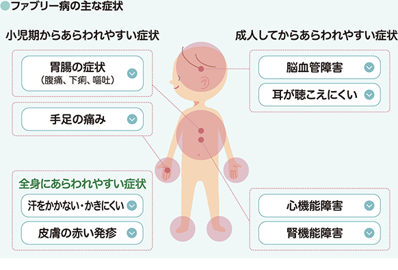 図1　ファブリー病の主な症状